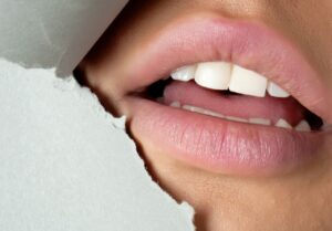 Read more about the article How Long Does Revanesse Lips Last? A Comprehensive Guide