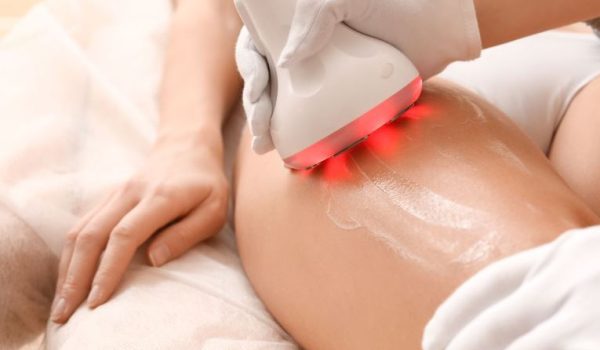 A professional performing a non-invasive skin treatment on a client's thigh using a handheld device with red lights. The device emits therapeutic heat while a gel is applied to the skin, enhancing the treatment's effectiveness. The technician wears white gloves for hygiene, ensuring a safe and clean procedure. This image illustrates advanced skincare technology aimed at improving skin texture and appearance.